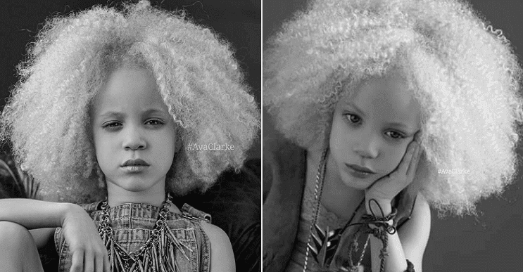 Ava Clarke: la niña albina de raza negra que cautiva en el mundo de la moda