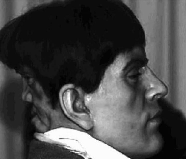 Este hombre tenía un segundo rostro en su nuca. No creerás lo que pasaba con ella