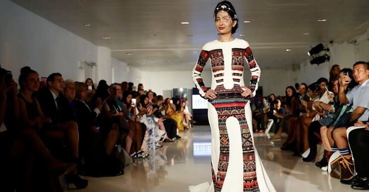 Sobrevivió a un ataque con ácido y hoy es modelo en Nueva York